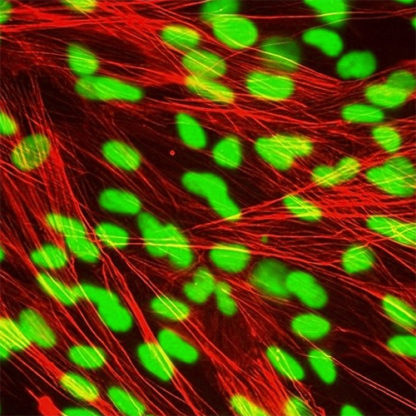 Human Pulmonary Artery Smooth Muscle Cells
