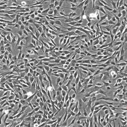 Human Bronchial Smooth Muscle Cells