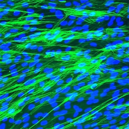 Human Tracheal Smooth Muscle Cells