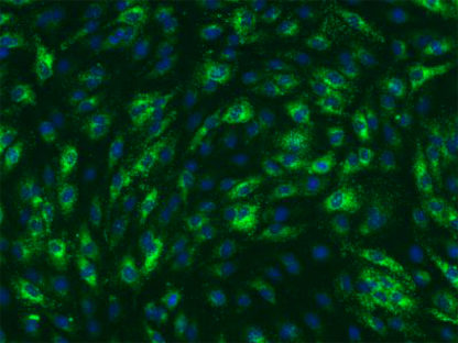 Immortalized Mouse Hepatic Sinusoidal Endothelial Cells