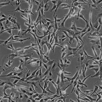 Human Renal Mesangial Cells