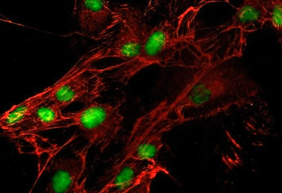 Human Renal Mesangial Cells