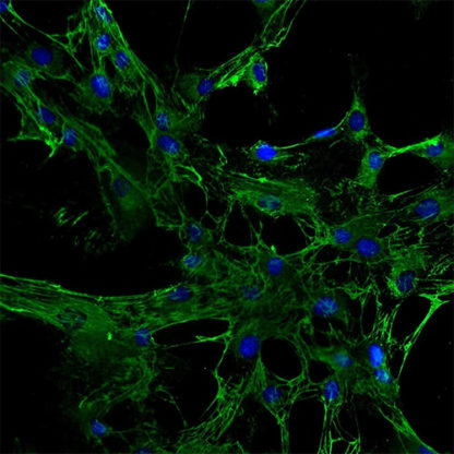 Human Renal Mesangial Cells