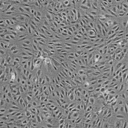 Human Renal Glomerular Endothelial Cells