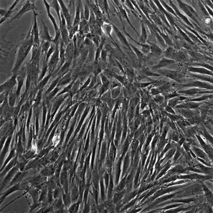 Human Kidney Fibroblasts