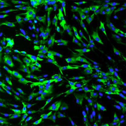 Human Kidney Fibroblasts