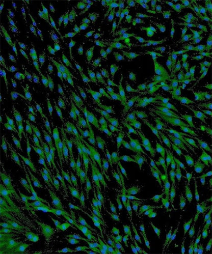 Human Mesenchymal Stem Cells