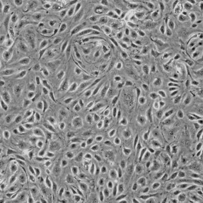 Human Colonic Microvascular Endothelial Cells