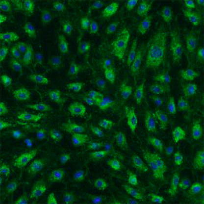 Human Colonic Microvascular Endothelial Cells