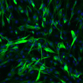 Porcine Retinal Pigment Epithelial Cells