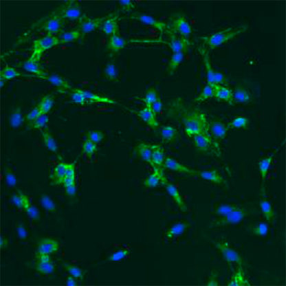 Human Oral Fibroblasts