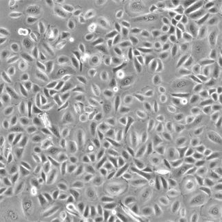 Human Conjunctival Epithelial Cells