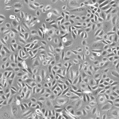 Human Conjunctival Epithelial Cells