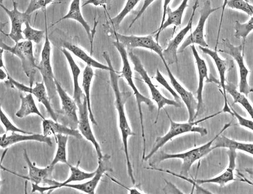 Human Trabecular Meshwork Cells