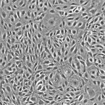 Human Mammary Microvascular Endothelial Cells