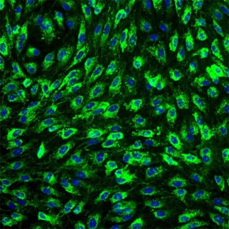 Human Mammary Microvascular Endothelial Cells