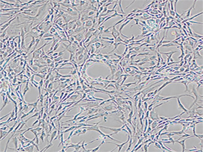 Rat Chondrocytes