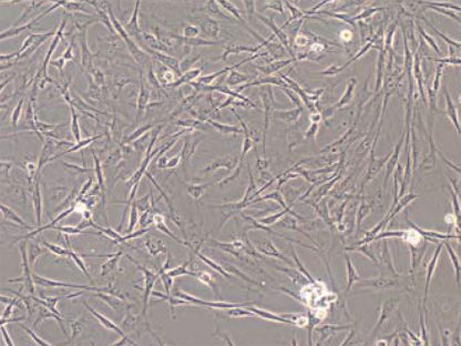 Rat Calvarial Osteoblasts