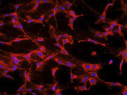 Rat Calvarial Osteoblasts