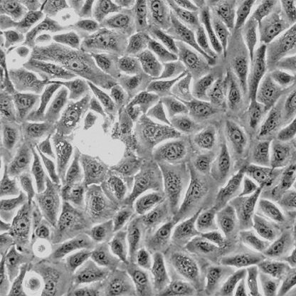 Human Urothelial Cells