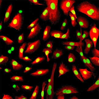 Human Urothelial Cells