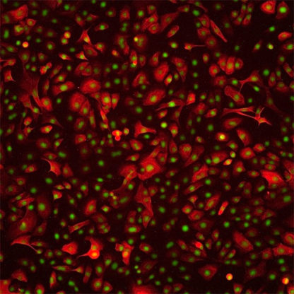 Human Prostate Epithelial Cells