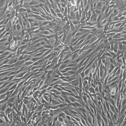 Human Prostate Fibroblasts