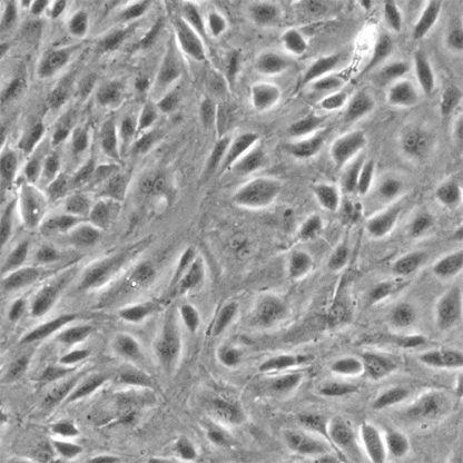 Human Prostate Microvascular Endothelial Cells