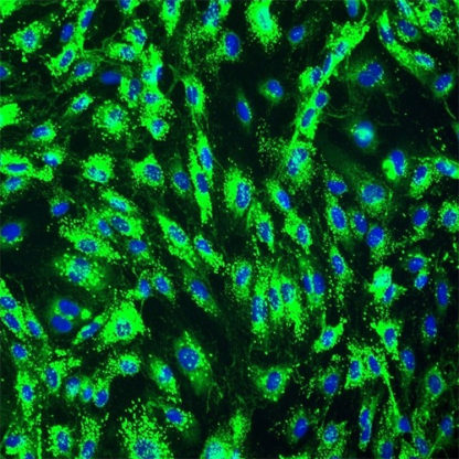 Human Prostate Microvascular Endothelial Cells