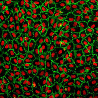 Human Umbilical Vein Endothelial Cells