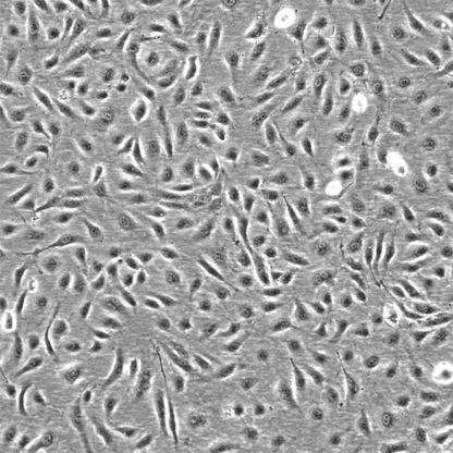 Human Umbilical Artery Endothelial Cells