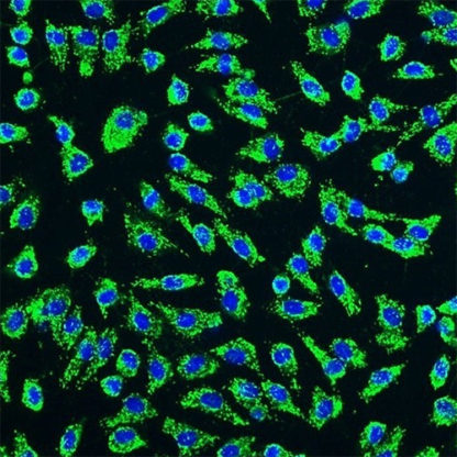 Human Umbilical Artery Endothelial Cells