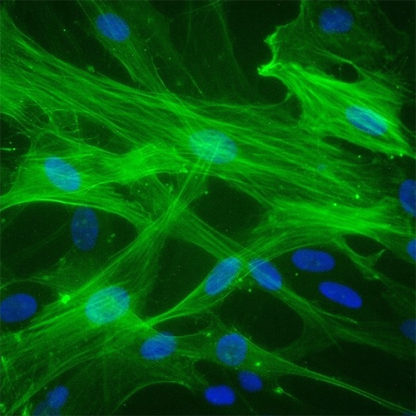 Human Umbilical Vein Smooth Muscle Cells