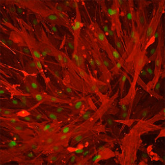 Human Umbilical Artery Smooth Muscle Cells