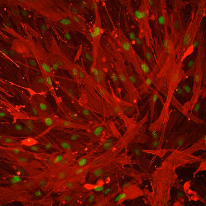 Human Umbilical Artery Smooth Muscle Cells