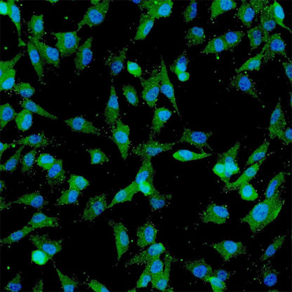 Human Umbilical Mesenchymal Stem Cells