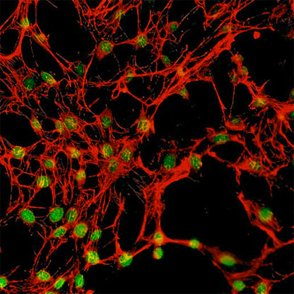 Human Chondrocytes