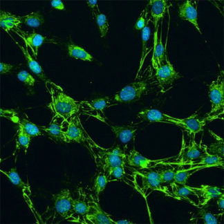 Human Synoviocytes