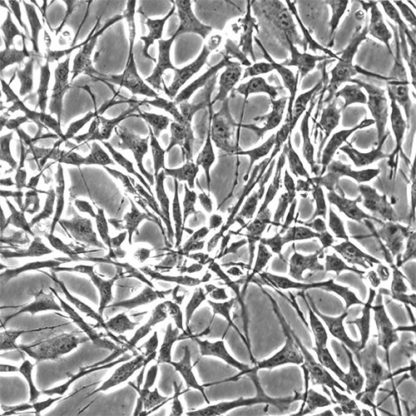 Human Synoviocytes