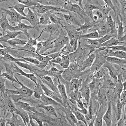 Human Nucleus Pulposus Cells