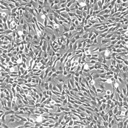 Human Anulus Fibrosus Cells