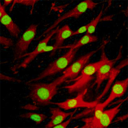 Human Skeletal Muscle Satellite Cells