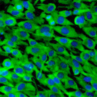 Human Skeletal Muscle Myoblasts