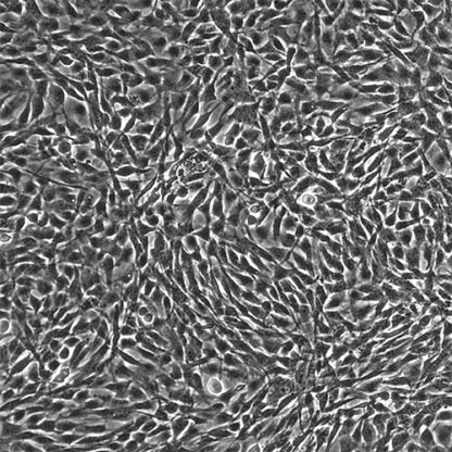 Human Skeletal Muscle Myoblasts