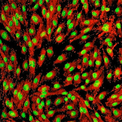 Human Ovarian Microvascular Endothelial Cells