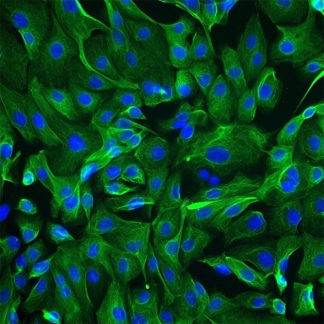 Human Ovarian Surface Epithelial Cells