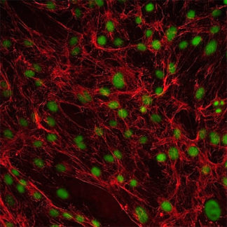 Human Ovarian Fibroblasts