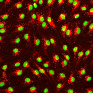 Human Placental Vascular Endothelial Cells