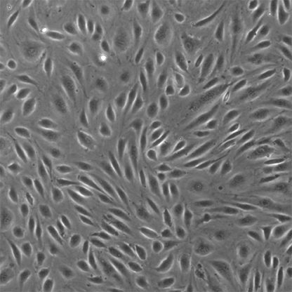 Human Placental Vascular Endothelial Cells