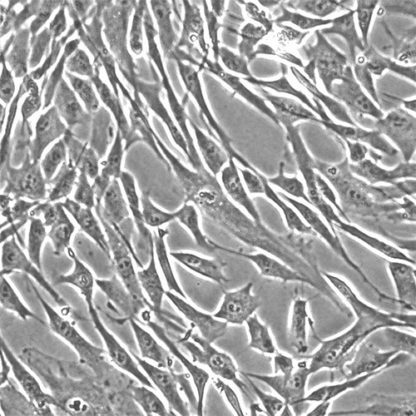 Human Bladder Stromal Fibroblasts